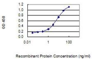 Detection limit for recombinant GST tagged WBSCR27 is 0. (WBSCR27 antibody  (AA 1-245))