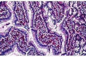 Rat Intestine: Formalin-Fixed, Paraffin-Embedded (FFPE) (GJB2 antibody  (Cytoplasmic Domain))