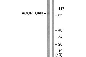 Western blot analysis of extracts from Jurkat cells, treated with Etoposide (25uM, 60mins), using Aggrecan (Cleaved-Asp369) antibody (#L0101). (Aggrecan antibody  (Cleaved-Asp369))