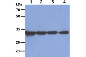 The Cell lysates (40ug) were resolved by SDS-PAGE, transferred to PVDF membrane and probed with anti-human OTUB1 antibody (1:5000). (OTUB1 antibody)