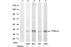 Image no. 1 for anti-Protein Phosphatase 2, Catalytic Subunit, alpha Isozyme (PPP2CA) (N-Term) antibody (ABIN319372) (PPP2CA antibody  (N-Term))