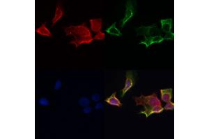 ABIN6259869 and ABIN6267009 staining Hela by IF/ICC. (AKT 1/2/3 antibody  (C-Term, pan))