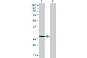 Western Blot analysis of HLA-DQB1 expression in transfected 293T cell line by HLA-DQB1 MaxPab polyclonal antibody. (HLA-DQB1 antibody  (AA 1-261))