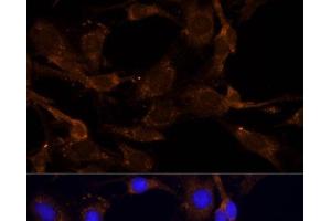 Immunofluorescence analysis of C6 cells using RPL27 Polyclonal Antibody at dilution of 1:100 (40x lens). (RPL27 antibody)