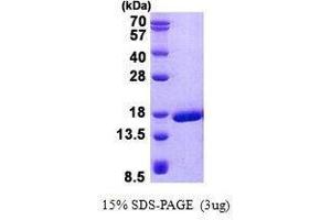 Figure annotation denotes ug of protein loaded and % gel used. (PRND Protein)