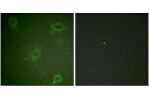 Immunofluorescence analysis of HeLa cells, using Amyloid beta A4 (Phospho-Thr743/668) Antibody. (APP antibody  (pThr743))