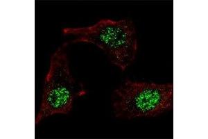 IF staining of HeLa cells with KLF4 antibody at 1:100, response is localized to the nuclei.
