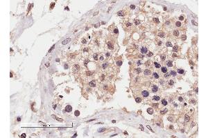 ABIN2559953 (4µg/ml) staining of paraffin embedded Human Testis. (SLC22A16 antibody  (Internal Region))