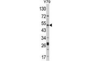 Western blot analysis of AKT1 (arrow) in Y79 cell line lysates (35ug/lane) using AKT1 / PKB  Antibody (C-term).
