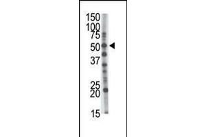 Antibody is used in Western blot to detect GCNT1 in mouse kidney tissue lysate.