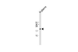 All lanes : Anti-GPX3 Antibody (Center) at 1:1000 dilution Lane 1: M. (GPX3 antibody  (AA 93-123))