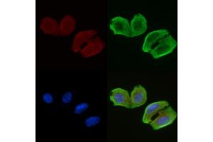 ABIN6256965 and ABIN6274452 staining Hela cells(30 min of UV treatment) by IF/ICC. (BRI3BP antibody  (N-Term))