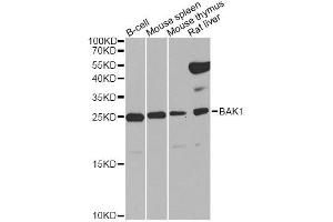 Western blot analysis of extracts of various cell lines, using BAK1 Antibody (ABIN5970038) at 1/1000 dilution.