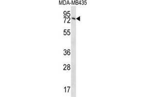 UNC84B Antibody (Center) western blot analysis in MDA-MB435 cell line lysates (35 µg/lane). (SUN2 antibody  (Middle Region))