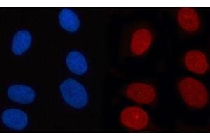 IF analysis of RANBP2 using anti-RANBP2 antibody (ABIN7602650). (RANBP2 antibody  (AA 906-2744))