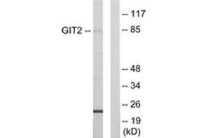 Western blot analysis of extracts from HepG2 cells, using GIT2 Antibody. (GIT2 antibody  (AA 361-410))