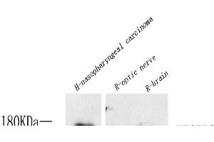 Western Blot analysis of various samples using FLK1 Polyclonal Antibody at dilution of 1:800. (VEGFR2/CD309 antibody)