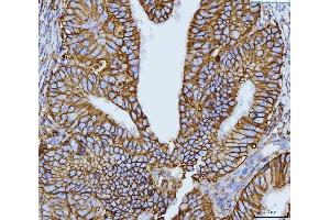 IHC analysis of CD147/Emmprin using anti-CD147/Emmprin antibody (ABIN7599999). (CD147 antibody  (AA 138-323))