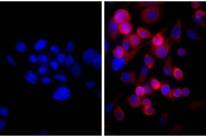 Human pancreatic carcinoma cell line MIA PaCa-2 was stained with Mouse Anti-Cytokeratin 18-UNLB and DAPI. (Goat anti-Mouse IgG (Heavy & Light Chain) Antibody (HRP) - Preadsorbed)