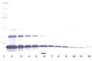 Image no. 3 for anti-Tumor Necrosis Factor Receptor Superfamily, Member 1A (TNFRSF1A) antibody (ABIN465075)