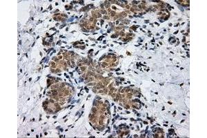 Immunohistochemical staining of paraffin-embedded breast tissue using anti-PTPRE mouse monoclonal antibody.