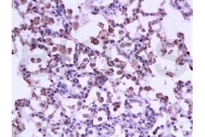 Formalin-fixed and paraffin embedded rat lung tissue labeled with Anti-STAT3 Polyclonal Antibody, Unconjugated at 1:200 followed by conjugation to the secondary antibody, (SP-0023), and DAB staining(ABIN738261) Formalin-fixed and paraffin embedded rat lung tissue labeled with Anti-STAT3 Polyclonal Antibody, Unconjugated at 1:200 followed by conjugation to the secondary antibody, (SP-0023), and DAB staining (STAT3 antibody  (AA 233-330))
