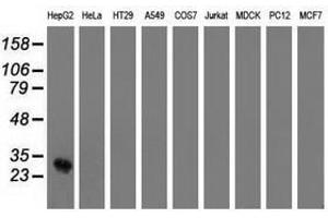 Image no. 2 for anti-OTU Domain, Ubiquitin Aldehyde Binding 2 (OTUB2) antibody (ABIN1499937) (OTUB2 antibody)