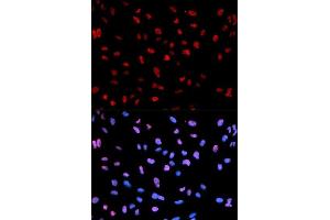 Immunofluorescence analysis of U2OS cells using Phospho-MEF2C-S396 antibody. (MEF2C antibody  (pSer396))