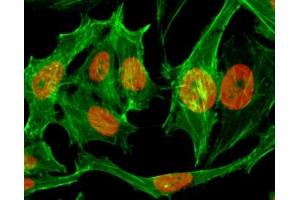 ICC/IF testing of human HeLa cells treated with sodium butyrate using recombinant H3K9me1 antibody (red). (Recombinant Histone 3 antibody  (H3K9me1))