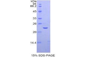 SDS-PAGE (SDS) image for Matrix Metallopeptidase 13 (Collagenase 3) (MMP13) (AA 66-238) protein (His tag) (ABIN2121609)