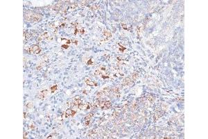 Immunohistochemistry of paraffin-embedded Rat ovary using SMPD1 / ASM Polyclonal Antibody at dilution of 1:100 (40x lens). (SMPD1 antibody)
