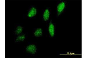 Immunofluorescence of purified MaxPab antibody to IPPK on HeLa cell.