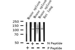 Western blot analysis of Phospho-NF kappaB p100/p52 (Ser869) expression in various lysates (NFKB2 antibody  (pSer870))