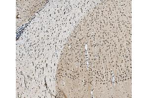 IHC analysis of TAF4 using anti-TAF4 antibody (ABIN7602114).