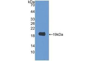 Detection of Recombinant GAL2, Rat using Polyclonal Antibody to Galectin 2 (GAL2) (Galectin 2 antibody  (AA 1-130))