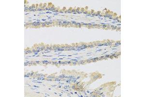 Immunohistochemistry of paraffin-embedded human prostate using INSL3 antibody at dilution of 1:100 (40x lens).