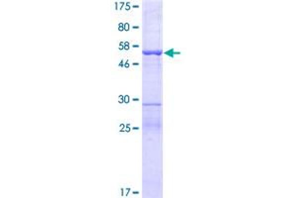 MIF4GD Protein (AA 1-256) (GST tag)