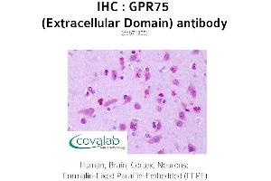 Image no. 1 for anti-G Protein-Coupled Receptor 75 (GPR75) (2nd Extracellular Domain) antibody (ABIN1735159) (GPR75 antibody  (2nd Extracellular Domain))