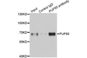 Immunoprecipitation analysis of 150 μg extracts of A549 cells using 3 μg PUF60 antibody (ABIN5974052).