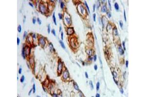 Used in DAB staining on fromalin fixed paraffin-embedded Stomach tissue (VAPA antibody  (AA 1-249))