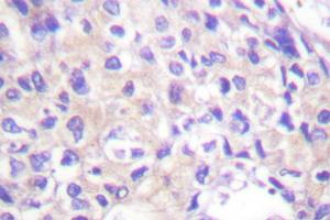 Image no. 1 for anti-Ribosomal Protein S6 Kinase, 90kDa, Polypeptide 1 (RPS6KA1) antibody (ABIN271935) (RPS6KA1 antibody)