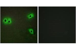 Immunofluorescence analysis of A549 cells, using Collagen XIII alpha1 Antibody. (COL13A1 antibody  (AA 641-690))
