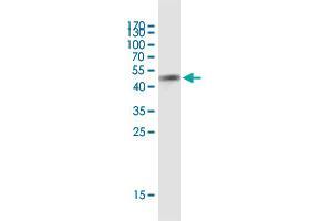Western Blot detection against Immunogen (52. (TMEM176A antibody  (AA 1-235))