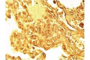 Image no. 1 for anti-serine Palmitoyltransferase, Long Chain Base Subunit 1 (SPTLC1) antibody (ABIN4620353) (SPTLC1 antibody)