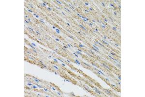 Immunohistochemistry of paraffin-embedded mouse heart using MYOT antibody (ABIN2564013) at dilution of 1:100 (40x lens).