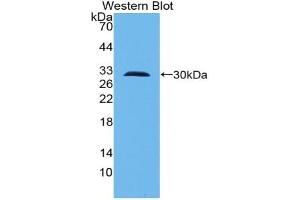 Western blot analysis of the recombinant protein. (TLR10 antibody  (AA 20-250))