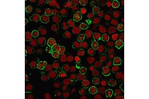 Immunofluorescence staining of Raji cells using CD20 Mouse Recombinant Monoclonal Antibody (rIGEL/773) followed by goat anti-Mouse IgG conjugated to CF488 (green). (Recombinant CD20 antibody)