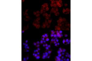 Immunofluorescence analysis of HepG2 cells using NUDT5 Rabbit mAb (ABIN7269071) at dilution of 1:100 (40x lens).