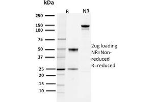 SDS-PAGE Analysis Purified PD-L1 Mouse Monoclonal Antibody (PDL1/2744).