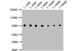 Western Blot Positive WB detected in: Raji whole cell lysate All lanes: CD19 antibody at 1:1000, 1:2000, 1:4000, 1:8000, 1:16000, 1:32000, 1:64000 Secondary Goat polyclonal to Mouse IgG at 1/10000 dilution Predicted band size: 61 kDa Observed band size: 95 kDa (CD19 antibody  (AA 20-291))